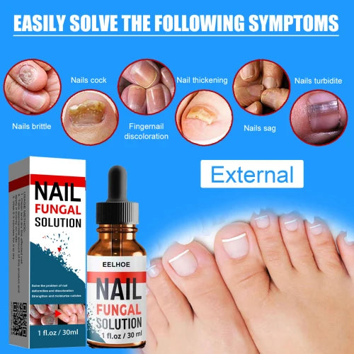 Darkened Nails Treatment