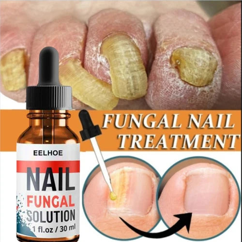 Darkened Nails Treatment