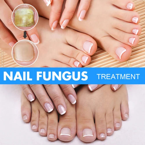 Darkened Nails Treatment