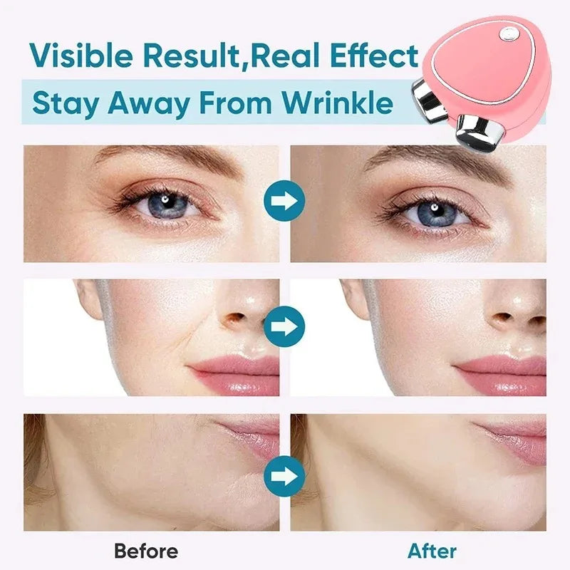Anti-Wrinkle Face Firming Beauty Instrument
